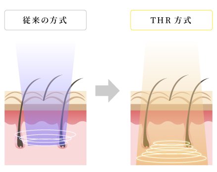 施術イメージ